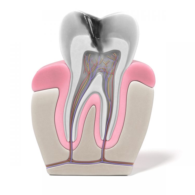 Traitement canalaire chez Dr Razzak Achouak Dentiste Orthodontiste Tanger