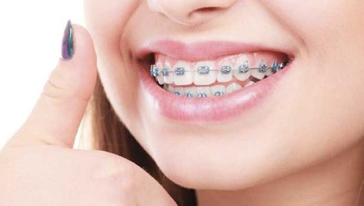 orthodontie tanger